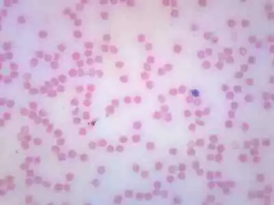 Human Blood Smear - Prepared Microscope Slide - 75x25mm - Eisco Labs • $7.99