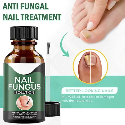 Antifungal Oil Nail Fungus Treatment Anti Fungal Infection Solution Nail Cure • $8.99