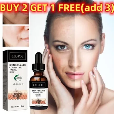 £5.68 • Buy GFOUK Melanin Correcting Facial Serum, Dark Spot Corrector Daily Face Serum FP