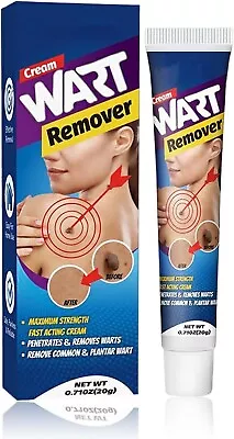 STRONG SKIN TAG REMOVER Cream NATURAL TREATMENT MOLES WARTS And TAGS • £9.79