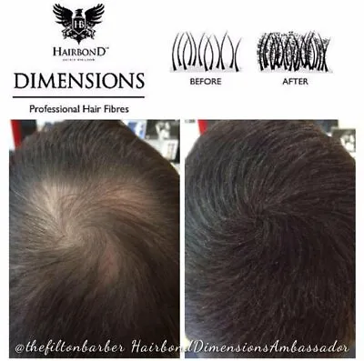 Hairbond Dimensions Professional Hair Building Fibres (DARK & LIGHT AVAILABLE) • £18.99