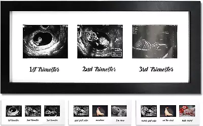 IHEIPYE Triple Sonogram Pregnancy Frame-Baby Ultrasound Picture Frame With Story • $24.76