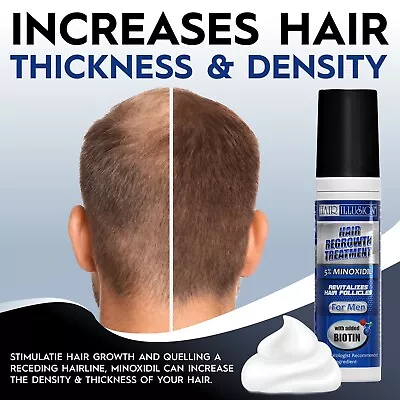 5% Minoxidil Foam For Men Hair Regrowth Treatment Biotin & Vitamins (1 Month) • $18