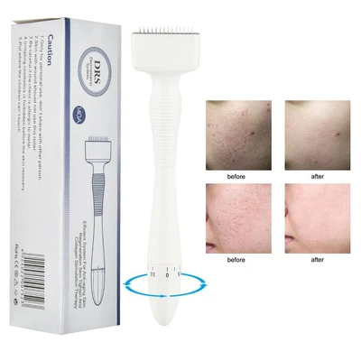 $34.65 • Buy 140 Stainless Steel Pins Micro Derma Roller Anti-Aging Therapy For Skin Care