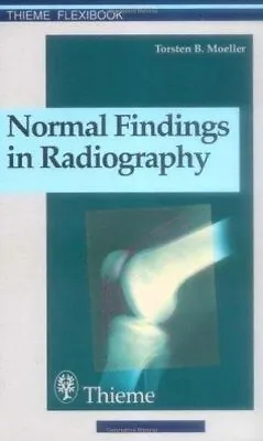 £22.42 • Buy Normal Findings In Radiography (Thieme Flexibook):  Zus-Arb: Torsten B M246ller