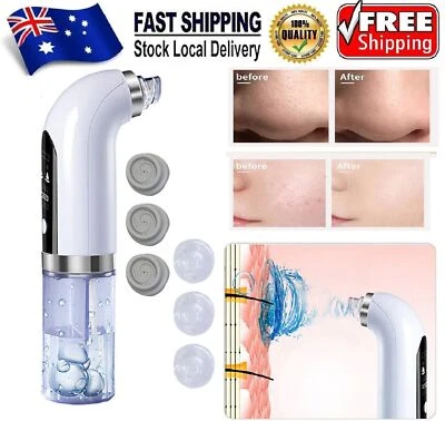 $27.99 • Buy Electric Blackhead Remover Vacuum Pore Acne Face Rechargeable Facial Suction Kit