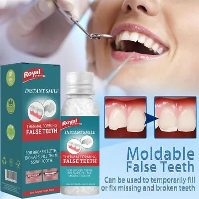 Teeth Glue Temporary Tooth Repair Kit Moldable Tooth Broken Teeth Gaps Repair • £4.26