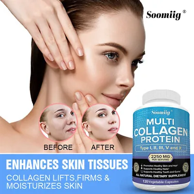 COLLAGEN PEPTIDES Types I II III V X Anti-Aging Skin Joint Support 120 Caps • $7.94