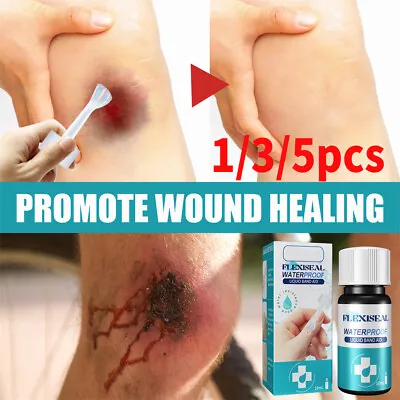 1/3/5pcs Body Skin Glue Medical Adhesive Liquid Band-aid Wounds First Aid HOT • $14.60