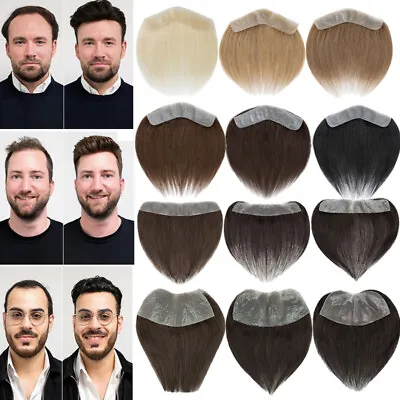 Full Skin PU Mens Frontal Human Hair Toupee For Forehead Hairline Loss Receding • $39.89