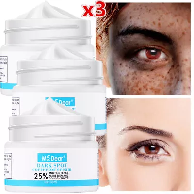 3PCS Whitening Freckle Cream Remove Melasma Pigment Melanin Acne Spot Dark Spots • $12.62