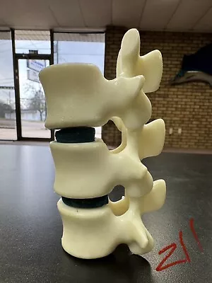 Vtg 3D Anatomical Model Human Spine-Disc Geigy Butazolidin Alka -  Missing Stand • $24