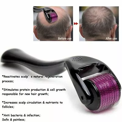 Beard Derma Roller Hair Beard Regrowth & Skin Rejuvena 540 Titanium Micro Needle • $6.49