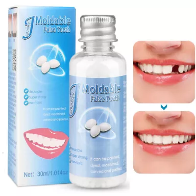 Resin False Teeth Solid Glue Temporary Tooth Repair Moldable Fix Broke Gap Teeth • £7.95