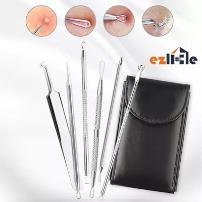 $12.79 • Buy 6Pcs Tool Whitehead Popper Extractor Remover Pimple Spot Comedone Blackhead Kit