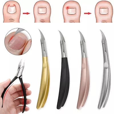 Professional Ingrown Toenail Tool Kit Toe Nail Clipper Set For Pedicure Manicure • $6.27