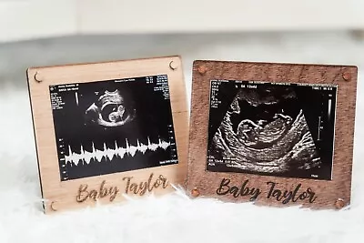 Ultrasound Frame Personalized - Frame With Personalization • $35