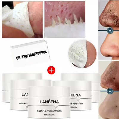 $14.95 • Buy LANBENA Blackhead Remover Cream Facial Nose Mask Plant Pore Strips Acne Peel Off