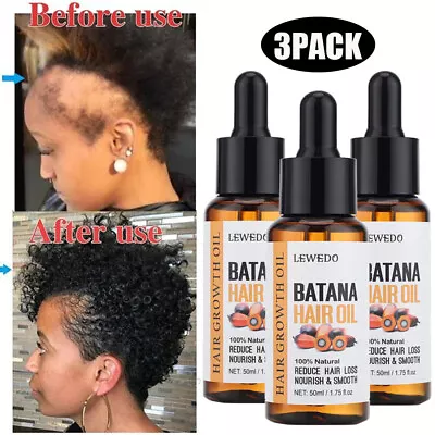 3Pcs Batana Oil Organic For Healthy Hair Growth Natural Anti Hair Loss Care 50ml • £12.95