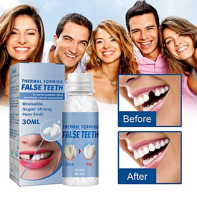 Teeth Solid Glue Resin False Temporary Tooth Repair Kits Moldable Gaps Denture  • $7.81