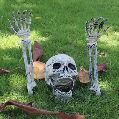 Human Skull+Arm Replica Model Realistic Life Size 1:1 Skeleton Halloween Decor • £9.90
