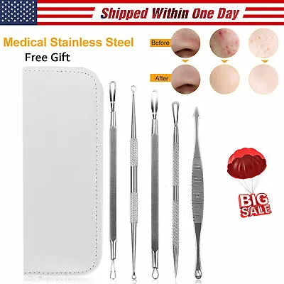 $6.99 • Buy Blemish Blackhead Remover 5 Piece Set Extractor Tools Pimple Removal Kit White