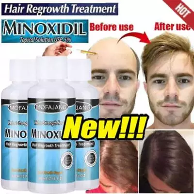 3PCS 60ml Extras Strength Mens Regrowth Treatment Regain Hair Growth Liquid 2023 • £10.95