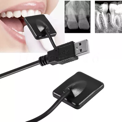 Woodpeckr Dental Digital X-Ray Sensor Intraoral X Ray Sensor Size 1.5 For Adults • $798