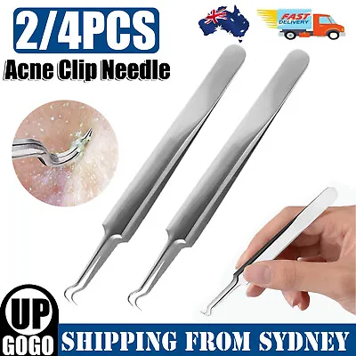 $5.98 • Buy 2-4X Curved Blackhead Acne Clip Needle Tweezers Pimple Popper Extractor Remover