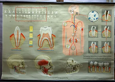 Medical Rollable Wallchart Vintage Poster Human Body Bit Jaws Teeth Care • $215.99