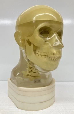 $3350 • Buy Vtg ACR Transparent Human Head X-Ray Phantom Skull - Medical Radiology CT MRI