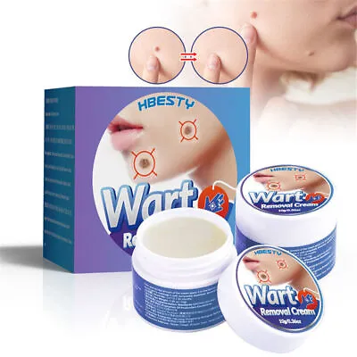 Wart Removal Cream Face Neck Foot Mole Corn Skin Care Tag Remover Treatment 10g~ • £6.59