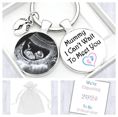 Mummy To Be Gift. Pregnancy Announcement Gift. Baby Scan Photo Keyring. • £5.95