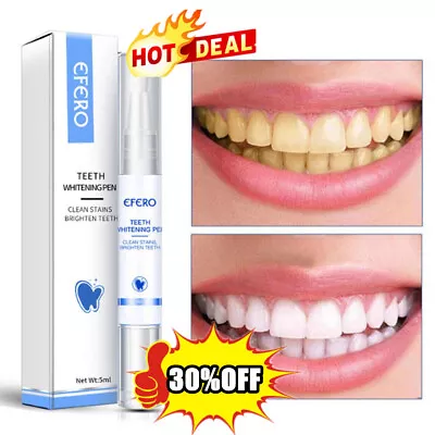 $4.63 • Buy Teeth Whitening Pens Stain Remover Teeth Whitening Kit Strips Safe