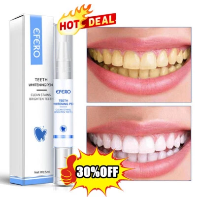 $4.63 • Buy Teeth Whitening Pens Stain Remover Teeth Whitening Kit Strips Safe