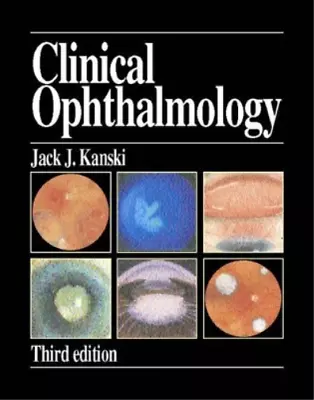 Clinical Ophthalmology: A Systematic Approach Kanski Jack J. Used; Good Book • £24.91
