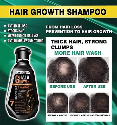 REGAIN GROWTH GROW HAIR LOSS REGROWTH SHAMPOO No Rogaine Finasteride Side Effect • $19.95