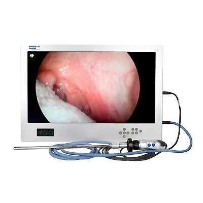 NEW Portable All-in-one Veterinary HD Video Endoscopy System (Multi-Outputs) • $4190