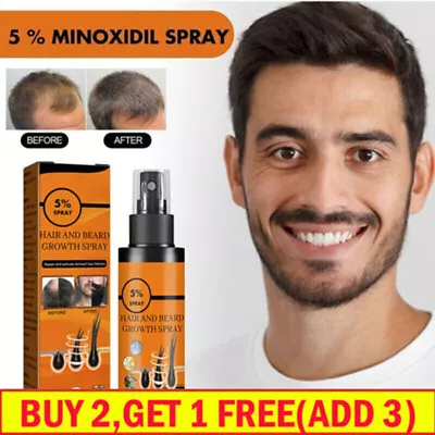 5 % Minoxidil Hair Growth Spray For Men Women 100ml Treatment Regrowth Hair UK • £5.99