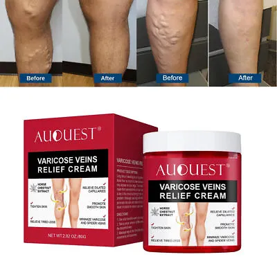 Varicose Veins Relief Cream Relieve Tired Legs Spider Pain Tighten Smooth Skin • $9.99