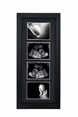 Pregnancy Ultrasound Scan 1st Photo 4 Aperture Black Frame Baby Shower Gift • £16.95