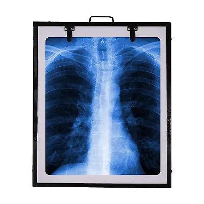 Xray View Box Digital For Clinic LED Premium Single Film With Brightness • $99.90