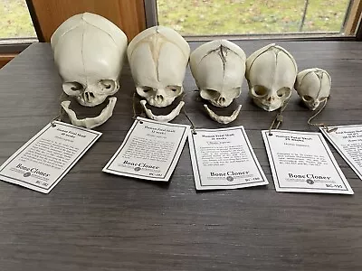 Bone Clones Fetal Human Skulls Set Of 5 Homo Sapiens 20 To 40 Weeks Medical • $375