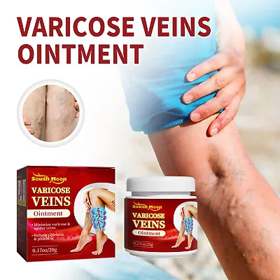 Best Cream Treatment For Varicose Veins Herbal For Varicose Veins Ointment/Cream • £4.10