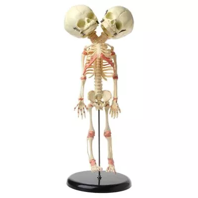 37cm Human Double For Head Baby Skull Skeleton Anatomy Brain Display Study Teach • £35.66