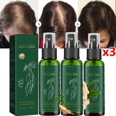 3X Ginseng Hair Growth Spray Anti Hair Loss Fast Regrowth Scalp Treatment Serum • £11.45