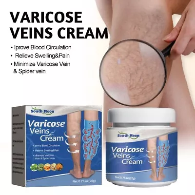 Varicose Veins Treatment Cream Vasculitis Phlebitis Spider Relief Pain Ointment • £4.09