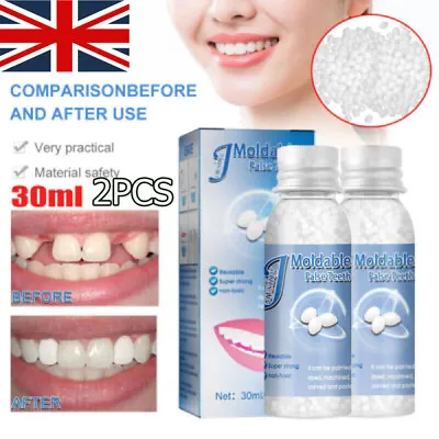 2~Temporary Tooth Repair Kit Teeth Gaps False Teeth Solid Granules Glue Adhesive • £7.95