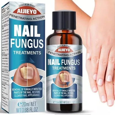 Nail Fungus Treatment For Toe And Finger Nail Fungal Infections #1 Natural Cure • $13.99