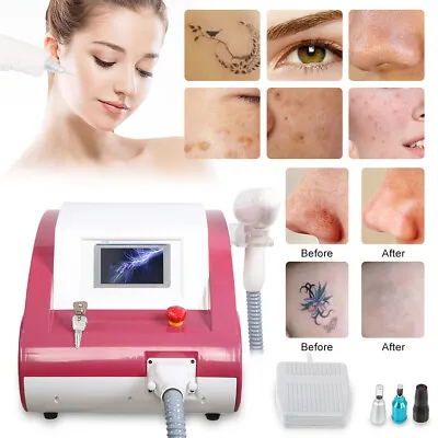 Q Switched ND Yag Laser Machine 1064nm/532nm/1320nm For Tattoo Freckle Removal • $488